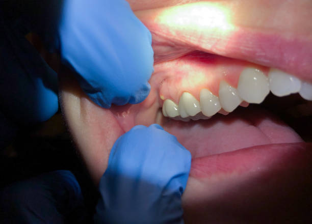 Best Emergency Dental Care for Trauma or Injury in Dortches, NC